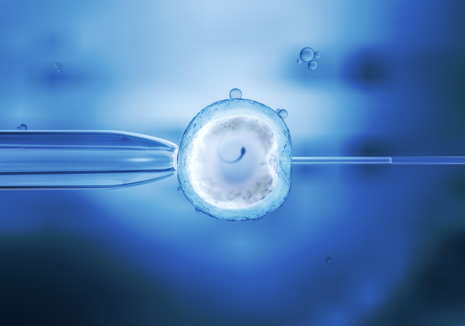 in vitro fertilization of an egg cell